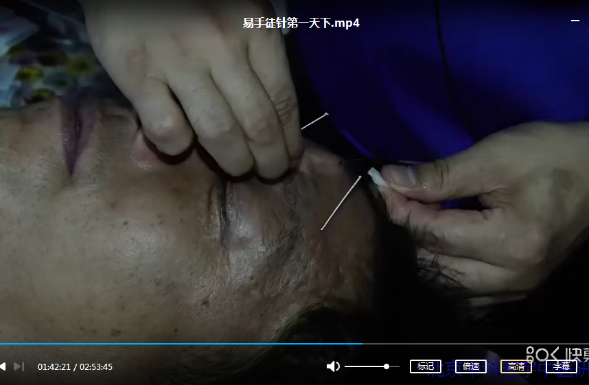 图片[3]-王连军易手徒针徒手整型美容驻颜塑体4天实操高清视频教程15小时【百度网盘下载】