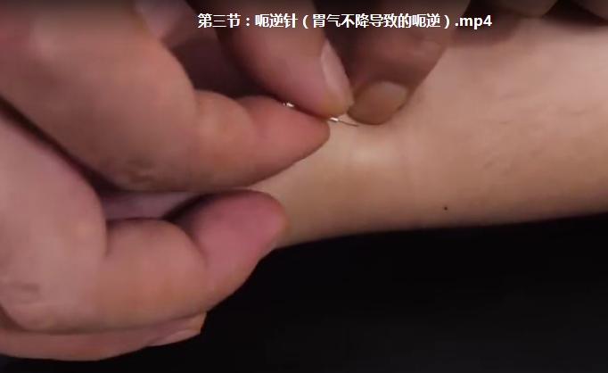 图片[7]-赵建新培元针法最新中医针灸高清视频课程全30集【百度网盘下载】