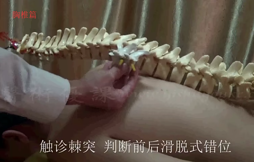图片[3]-祝栋安正骨技巧大揭秘视频教程脊椎力学分析全面正骨剖析200分钟【百度网盘下载】