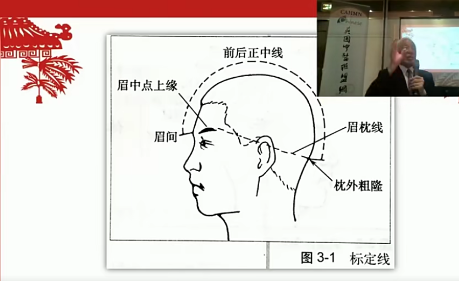 图片[4]-焦氏头针疗法焦顺发头针培训班高清视频教程【百度网盘下载】