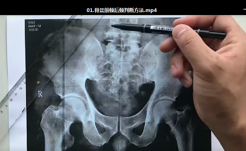 图片[3]-2020三个好医生李正军全脊柱X线颈胸腰读片高清视频教程【百度网盘下载】