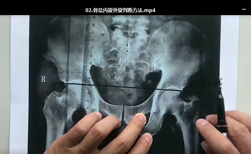 图片[4]-2020三个好医生李正军全脊柱X线颈胸腰读片高清视频教程【百度网盘下载】