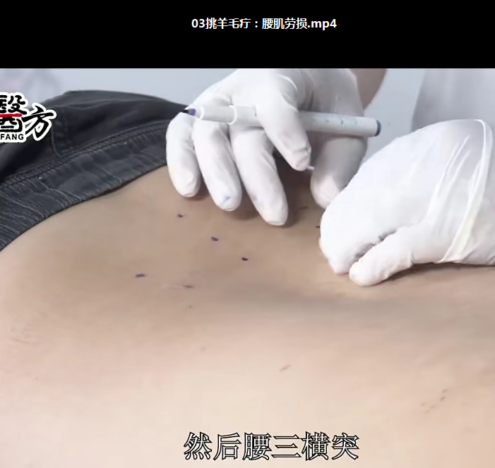 图片[4]-刘涛挑羊毛疔实战绝技颈椎落枕肩周炎脚趾麻8节实操高清视频教程【百度网盘下载】