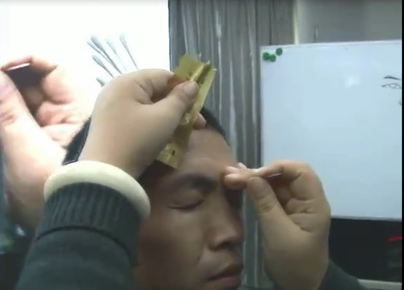 图片[5]-张秀春眼针疗法近视眼老花眼民间蒙医培训视频教程400分钟干货【百度网盘下载】