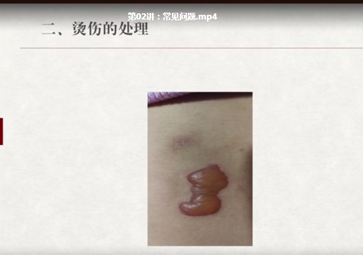 图片[5]-阅素灵中医艾灸视频教程扶阳祛湿补泄手法治疗常见病25讲【百度网盘下载】