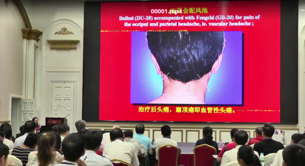 图片[3]-国医大师石学敏针灸传承培训班11小时讲座视频教程【百度网盘下载】