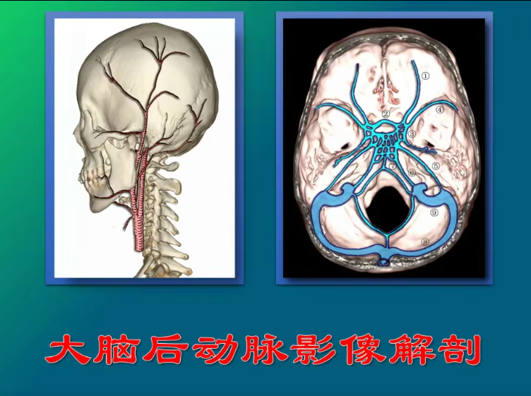 图片[12]-神经系统解剖进阶课高清视频教程血管颅脑脊髓神经解剖影像学【百度网盘下载】