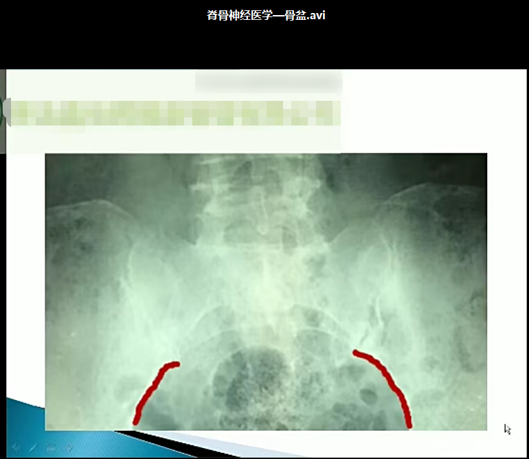 图片[4]-柳泽林正骨手法高清视频教程颈椎胸椎腰椎骨盆矫正教学【百度网盘下载】