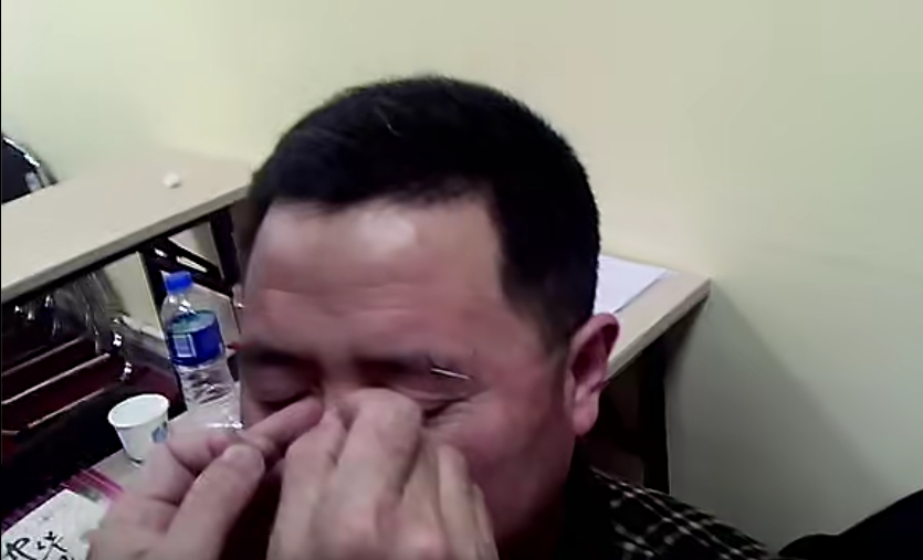 图片[4]-彭静山观眼识病眼针疗法视频教程中医针灸学习资料-百度网盘下载