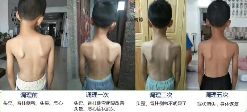 图片[5]-正骨培训：一站式掌握全身关节疼痛解决方案就学“痛立止理骨术”柔性正骨培训班