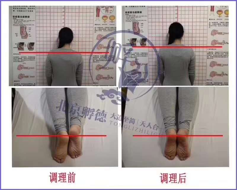 图片[7]-正骨培训：一站式掌握全身关节疼痛解决方案就学“痛立止理骨术”柔性正骨培训班