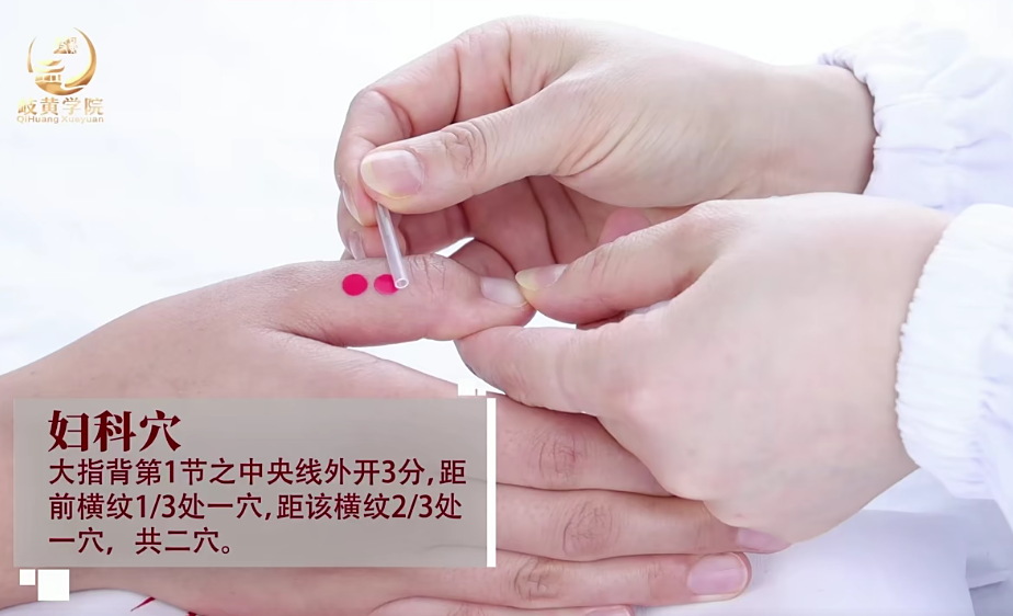 图片[7]-董氏奇穴针灸视频教程:郑承濬精选特效43讲20种常见病针刺配穴精讲课-百度网盘下载