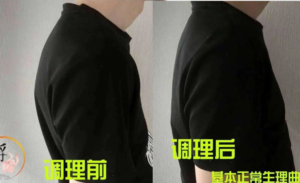 图片[6]-正骨培训：一站式掌握全身关节疼痛解决方案就学“痛立止理骨术”柔性正骨培训班
