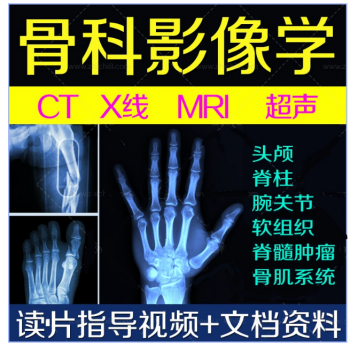 【骨科影像学诊断视频教程】脊柱胸腰椎骨科读片阅片指导百度网盘下载-正骨教程博客