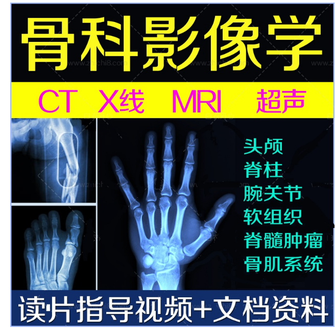 图片[1]-【骨科影像学诊断视频教程】脊柱胸腰椎骨科读片阅片指导百度网盘下载
